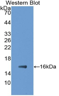 FABP5/E-FABP Antibody (C2)