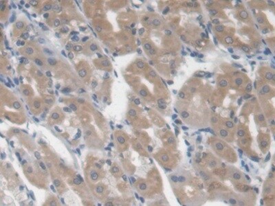 Galectin-3BP/MAC-2BP/LGALS3BP Antibody (D5)