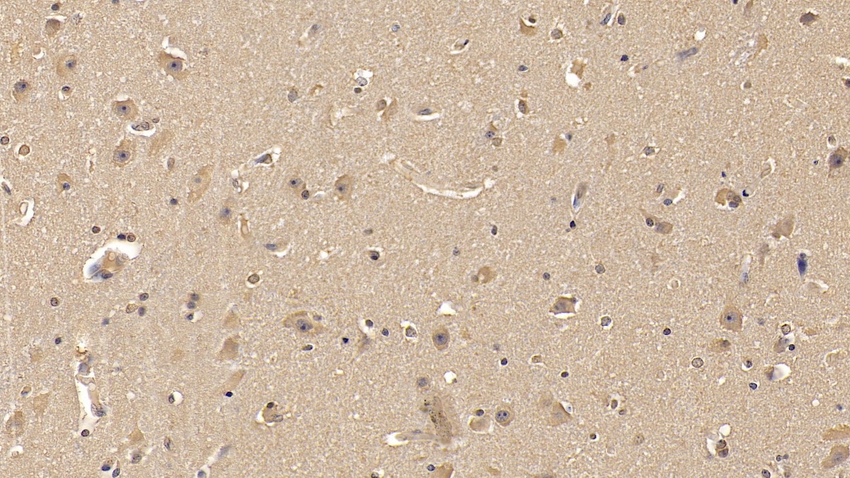 MMP-25/MT6-MMP Antibody (C6)