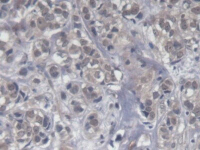 KIR2DS4/CD158i Antibody (C15)