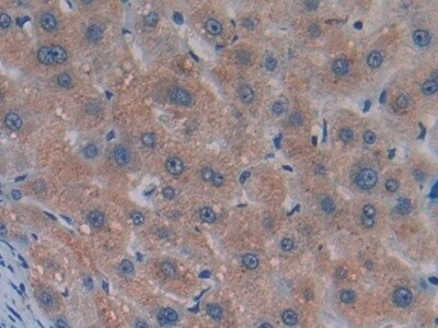 GDF-8/Myostatin Antibody (A11)