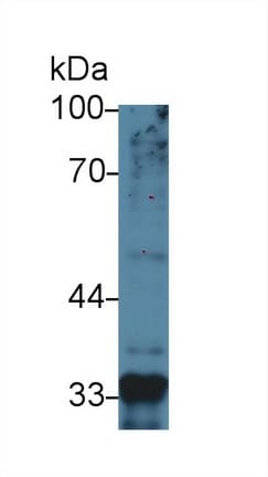 GDF-8/Myostatin Antibody (A11)