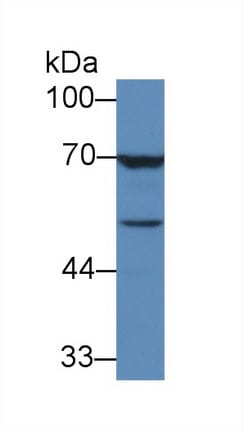 TGF-beta 3 Antibody (C1)