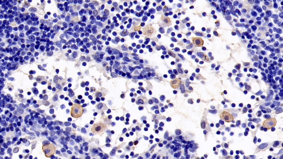 TLR5 Antibody (8-1#)