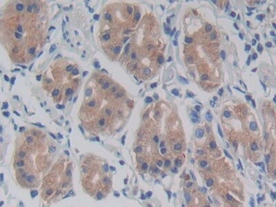 TLR5 Antibody (C6)