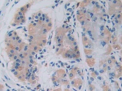 GHRH Antibody (C2)