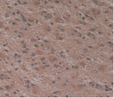 ATN1 Antibody (C1)