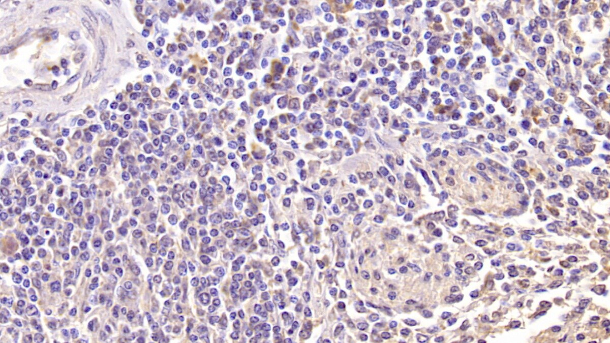 NKG2D/CD314 Antibody (C1)