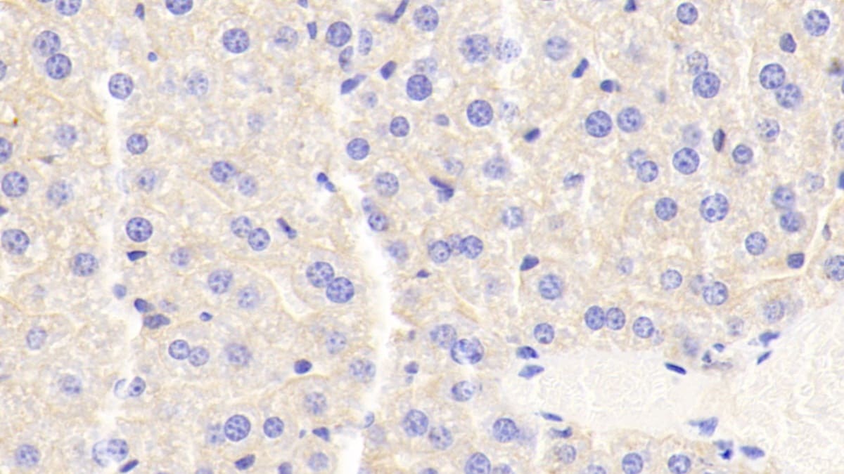 Apolipoprotein CIII Antibody (D6)