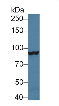 MTTP Antibody