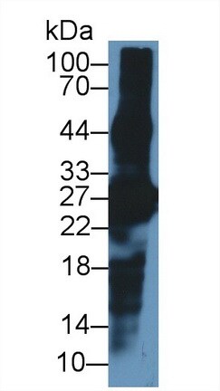 CRYBA1 Antibody