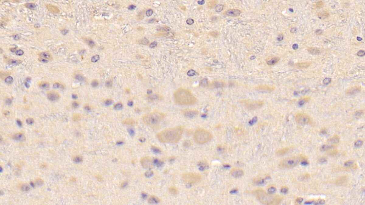 CRYBA1 Antibody