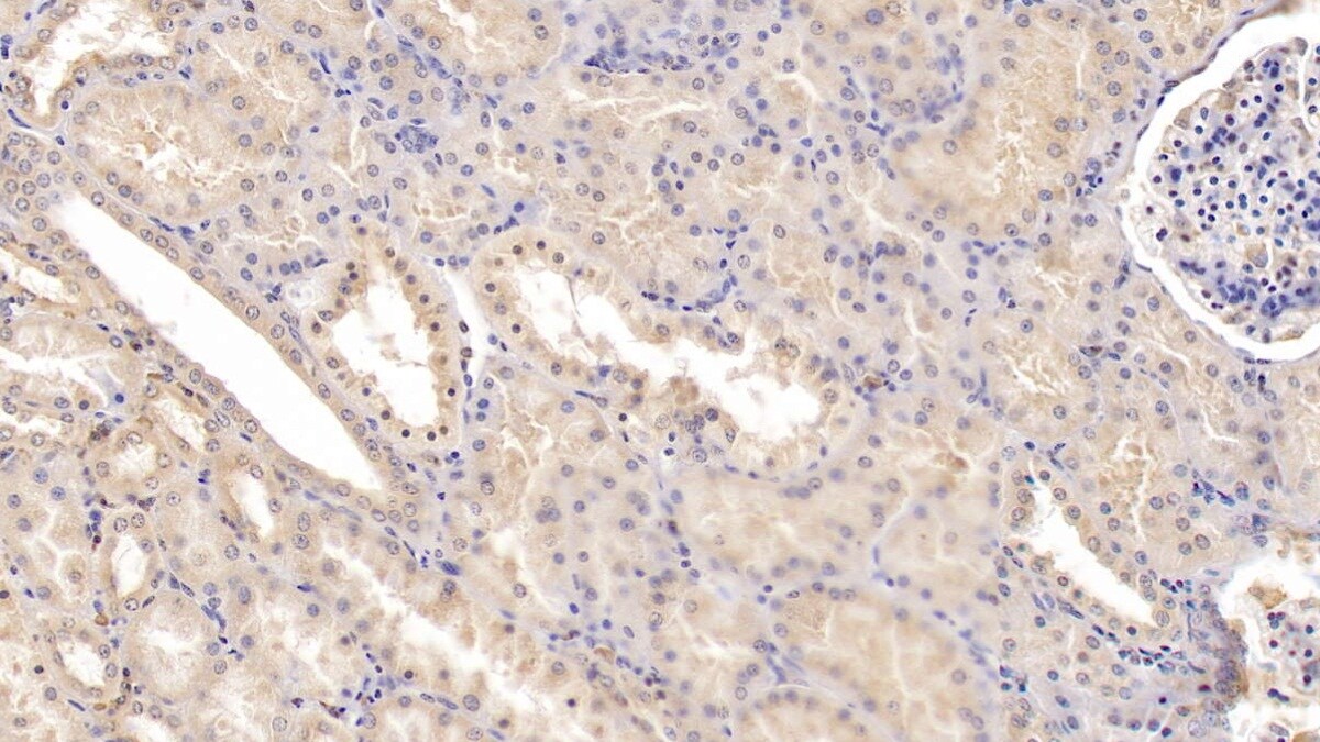 Tie-1 Antibody (C2)