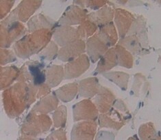 PRKAG3 Antibody
