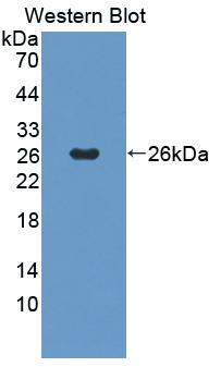 PANK1 Antibody