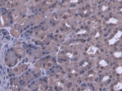 PANK1 Antibody