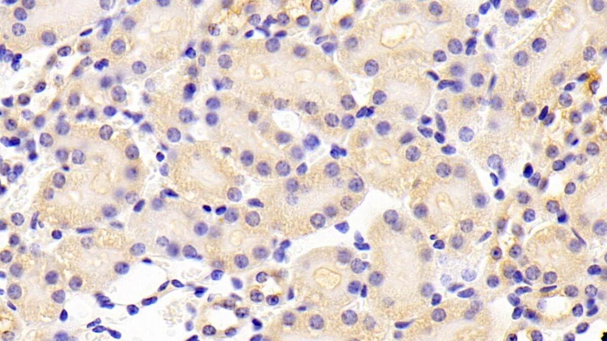 ABCA5 Antibody