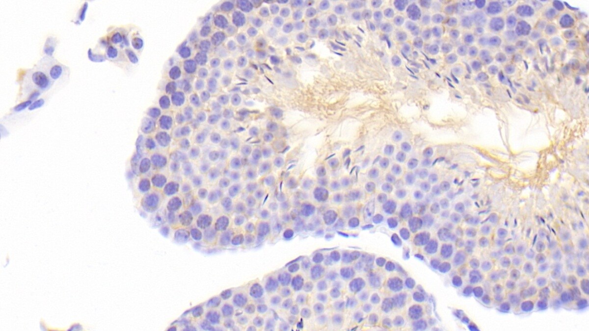 ABCA6 Antibody