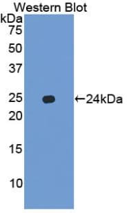 CXCL15/Lungkine Antibody