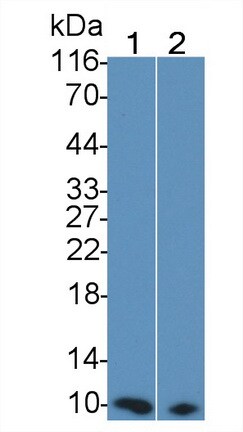 S100A/B Antibody (C13)