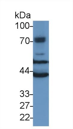 TUBB6 Antibody