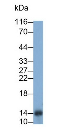 TFF2 Antibody (1-2#)