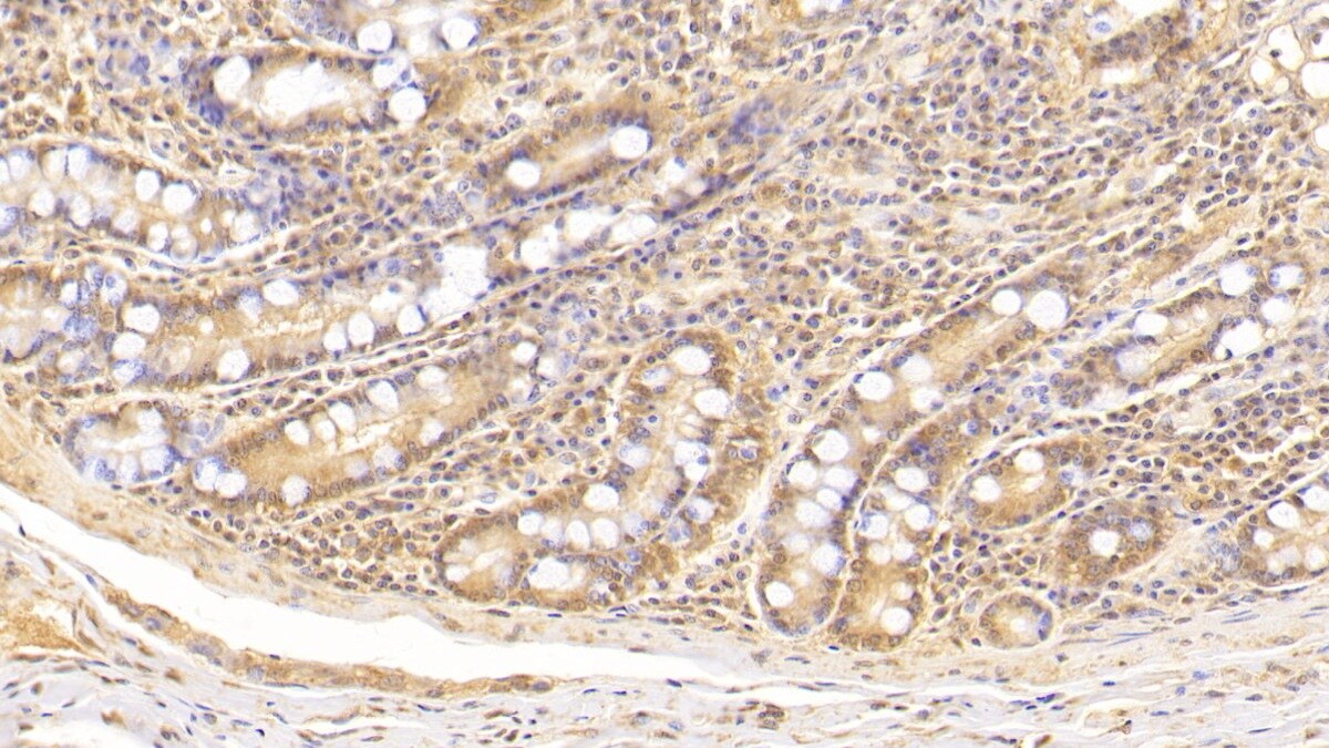 Complement Component C5a Antibody (D4)