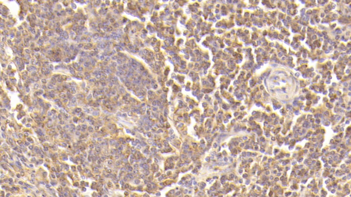 Complement Component C5a Antibody (D5)