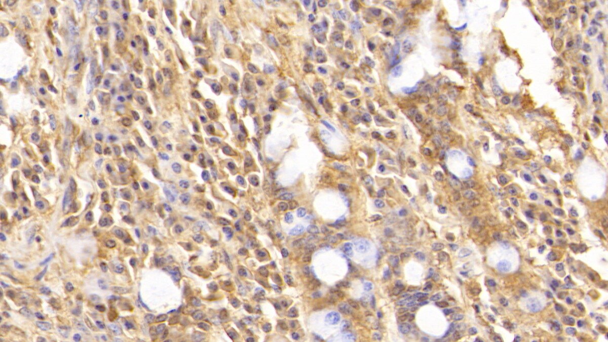 Complement Component C5a Antibody (D5)
