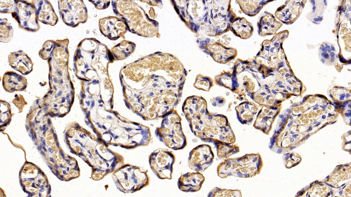 Placental Lactogen/CSH1 Antibody (C3)