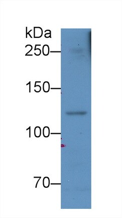 Complement Component C5a Antibody (D2)