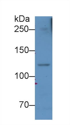 Complement Component C5a Antibody (D2)