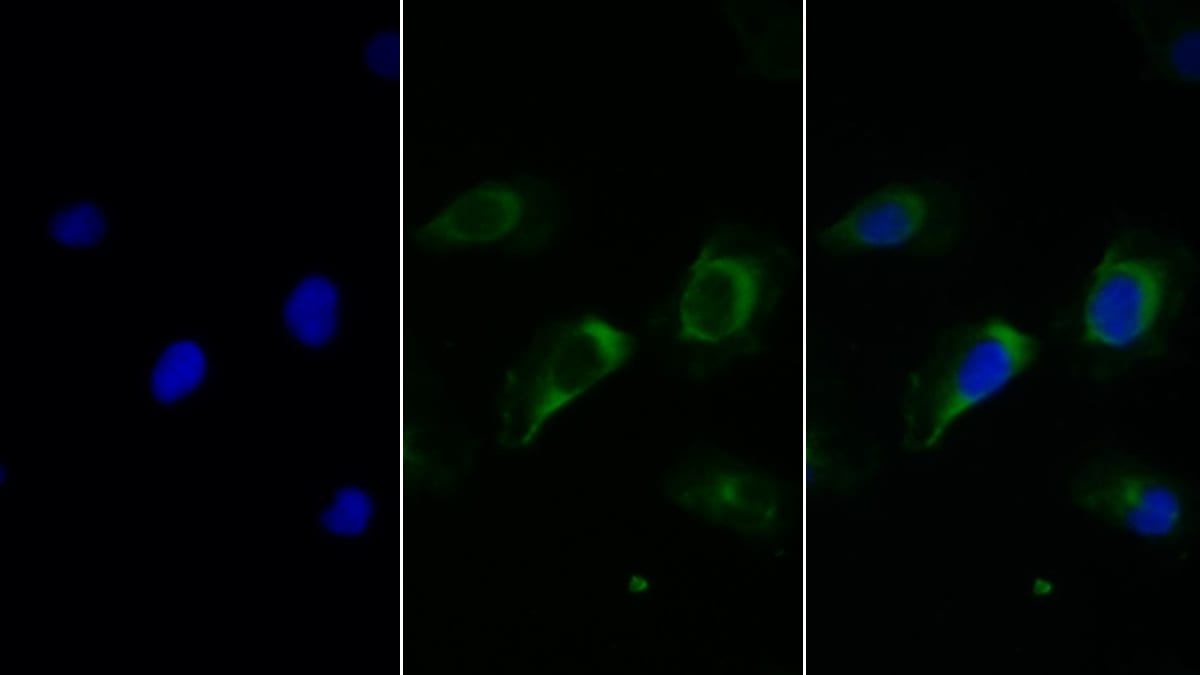 Fc gamma RIIIB/CD16b Antibody (C1)