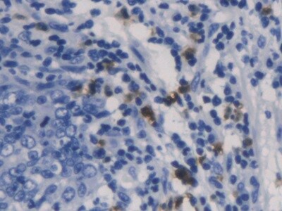 Galectin-10 Antibody (C2)