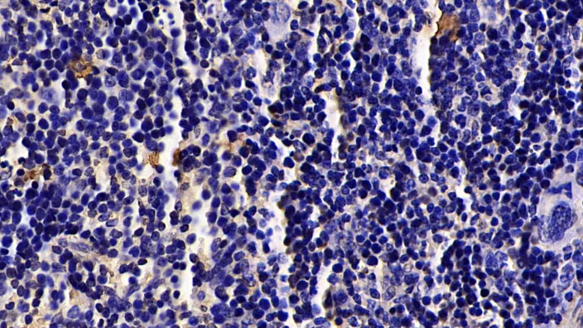 Granzyme K Antibody (C3)