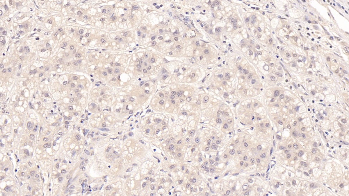 MBP-1 Antibody (D1)