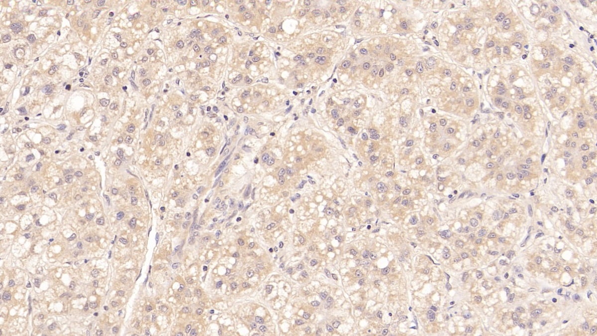 MBP-1 Antibody (D2)