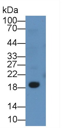 CD3 delta Antibody (C6)