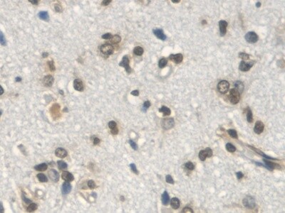 VGF Antibody (13#)