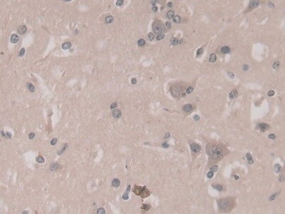 TGF-beta 3 Antibody (C14)