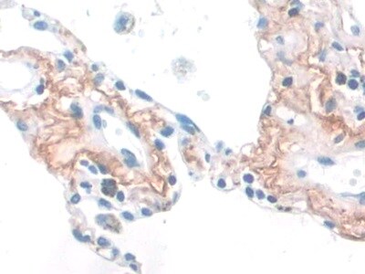 Elastin Antibody (C4)