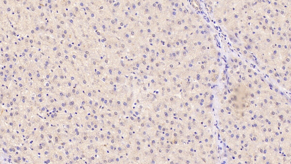 Angiogenin Antibody (C1)