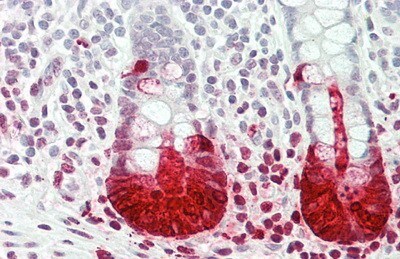 Reg3A Antibody (4#)