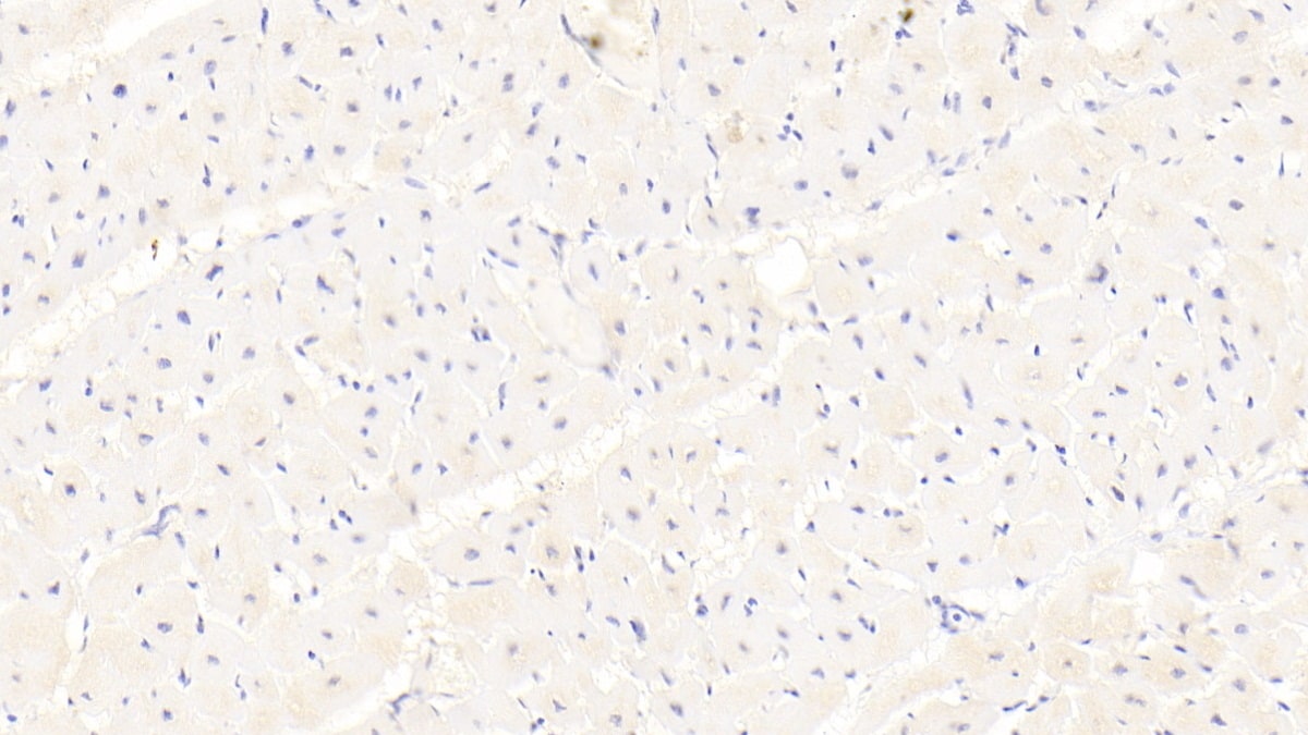 NCOA3/AIB1 Antibody (D3)