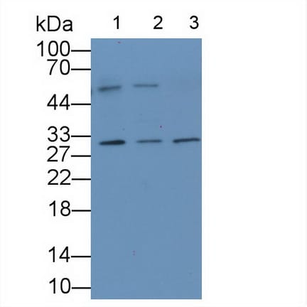 IL-36 alpha/IL-1F6 Antibody (C1)