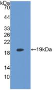 LPCAT3 Antibody (6-2#)