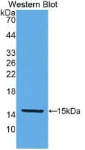 Klotho beta Antibody (8#)