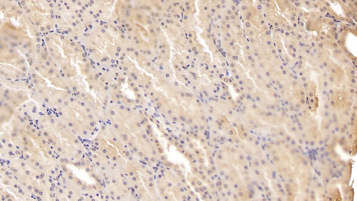 ADAMTS9 Antibody (D2)