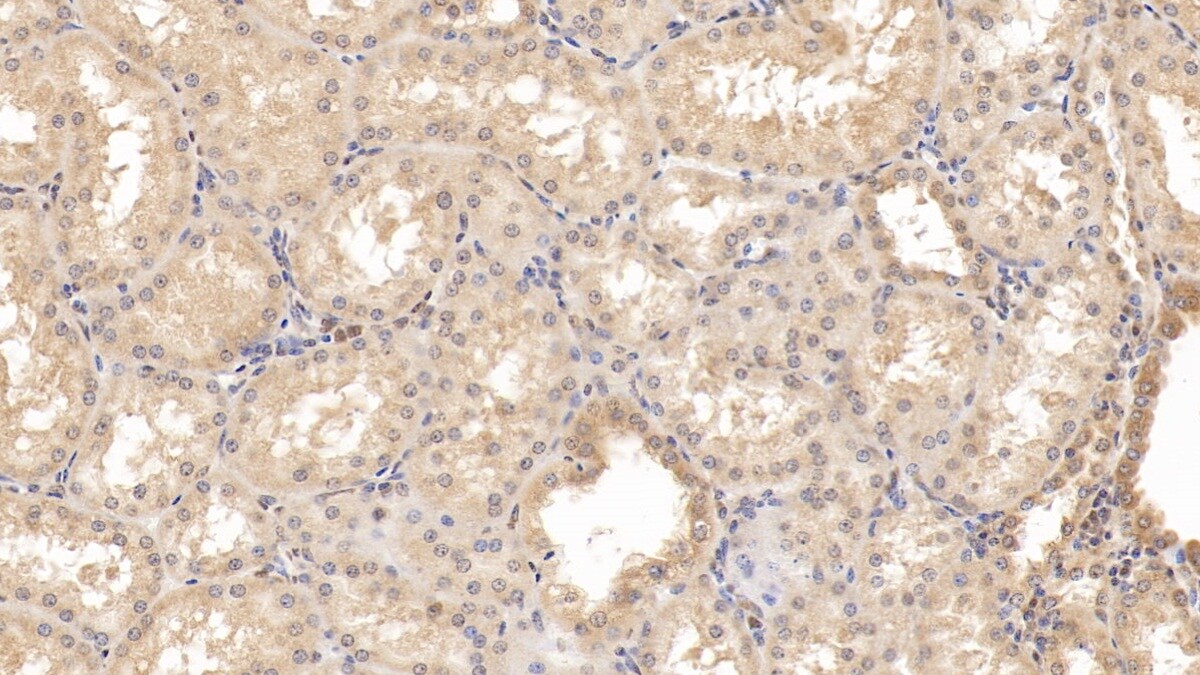 Rab5a Antibody (C4)