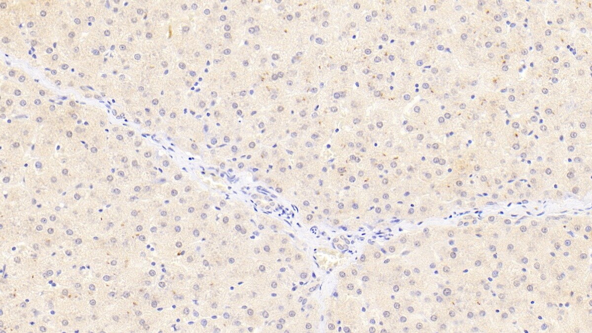 Monoglyceride Lipase Antibody (D3)